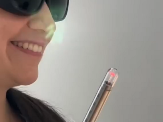 LVR laserová vaginální rejuvenace