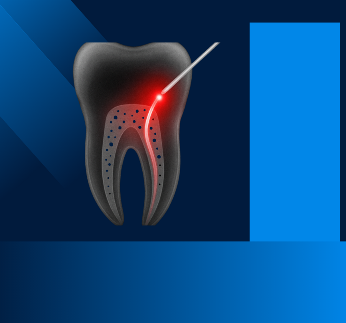 Dezinfekce koř. kanálku