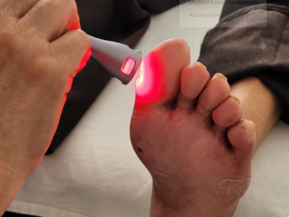 Průběh ošetření