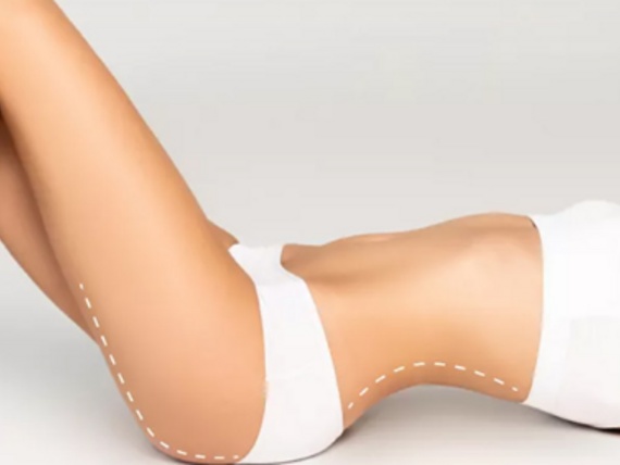 Klinické výhody laserové modelace těla