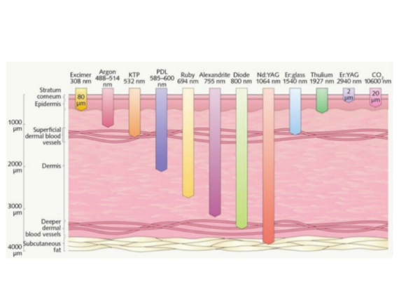 ORL - laser s výhodou oproti CO2 a KTP